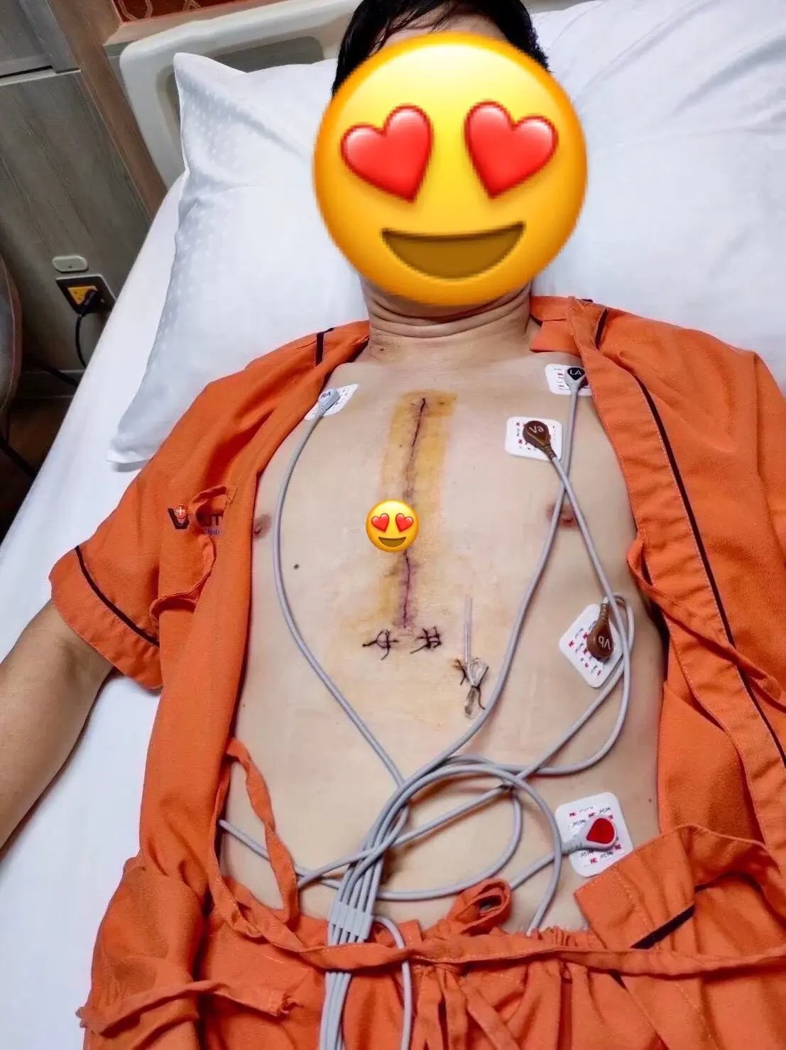 Heart valve surgery patient